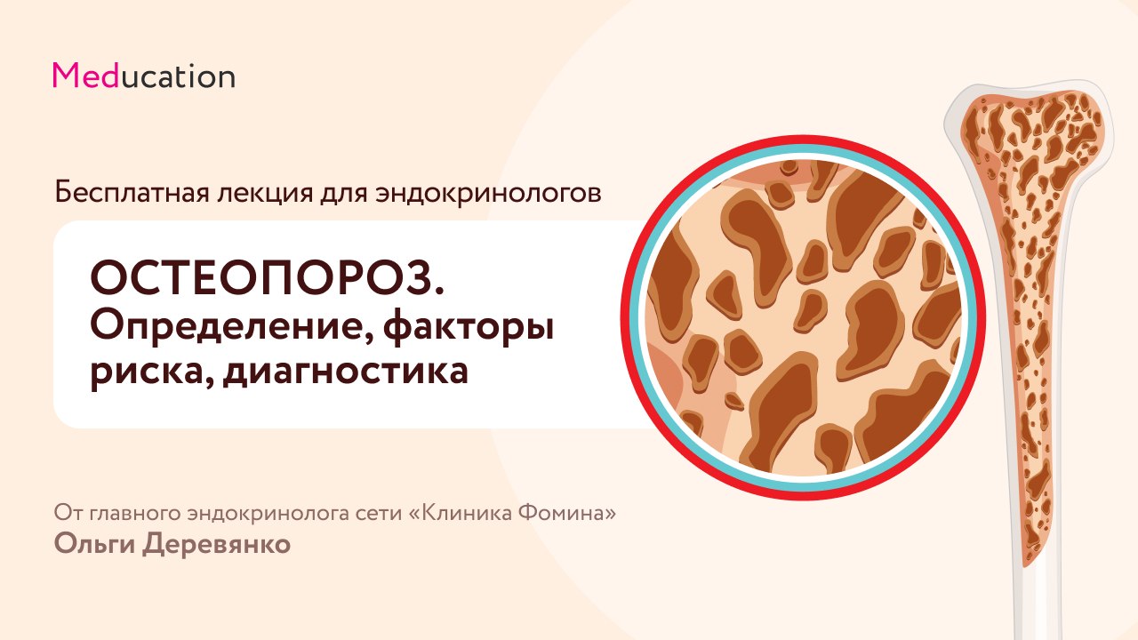 Все про остеопороз для эндокринологов!